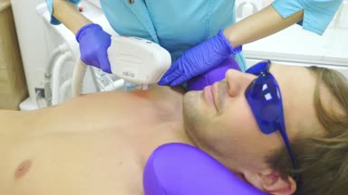 Erkek lazer epilasyon. bir doktor eldiven saç karın ve göğüs bir adamın kaldırır. 4k, yakın çekim.