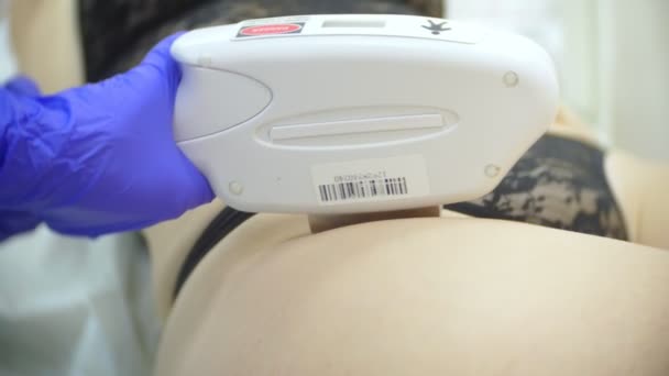 Laser hair removal. doctor in gloves. 4k, close-up. — Stock Video