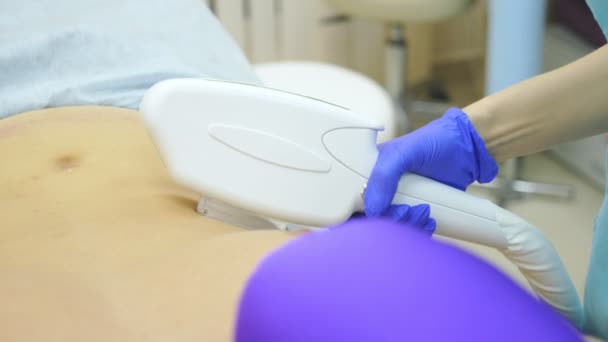 Depilación láser masculino. un médico con guantes quita el pelo del abdomen y los senos de un hombre. 4k, primer plano . — Vídeos de Stock