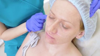 Bir plastik cerrahın elleri kontür hastalar yüzünde çizmek. 4 yüz kontur Plasti yordam için k..