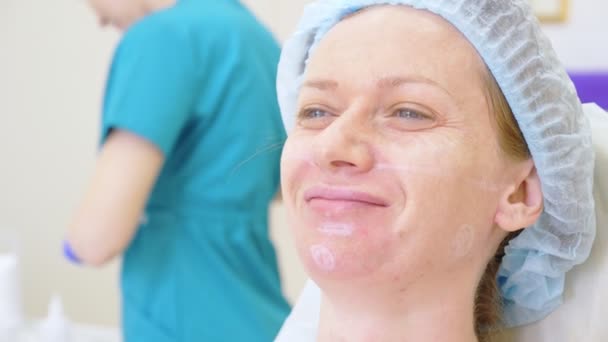 Die Hände eines plastischen Chirurgen zeichnen Konturen auf das Gesicht des Patienten. 4k. für das Verfahren der Konturplastik des Gesichts. — Stockvideo
