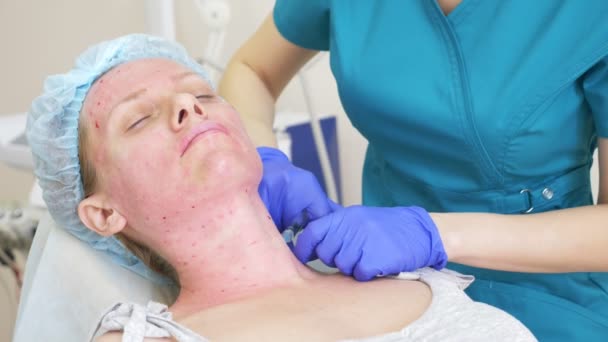 Косметолог делает уколы в лицо пациентке. концепция красоты и косметологии. 4k. биоревитализация — стоковое видео