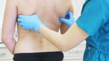 kalın kadın tıbbi liposuction için hazırlar. Doktor marker, arkadaki işareti çizer. 4k