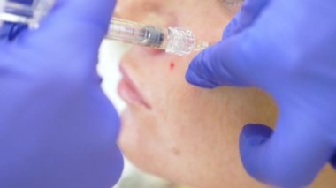 Doktor Şevval özçelik güzellik bayan hasta karşısında enjeksiyonları yapar. Güzellik ve kozmetik kavramı. 4 k. kontur plastik