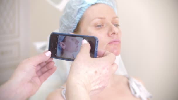 Alguém faz uma foto no telefone enquanto trabalha como esteticista para publicidade em redes sociais. rastrear o resultado antes e depois. 4k — Vídeo de Stock