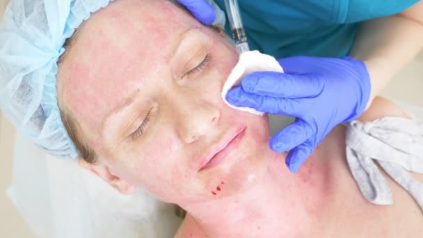 メスの患者の顔に注射を医師美容師になります。美容や美容のコンセプトです。4 k. 輪郭プラスチック — ストック動画