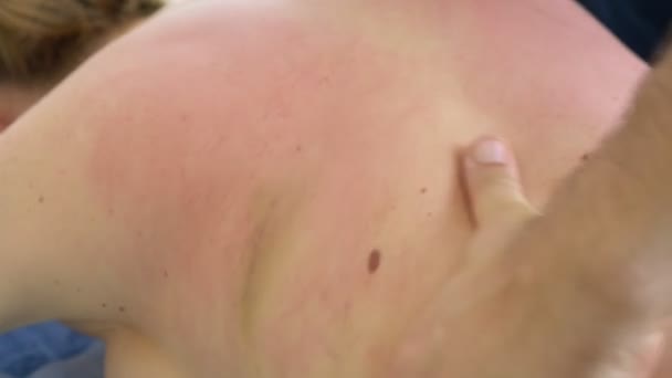 Terapeuta de massagem masculina faz massagem para mulheres, massagem anti-celulite. 4k, close-up — Vídeo de Stock