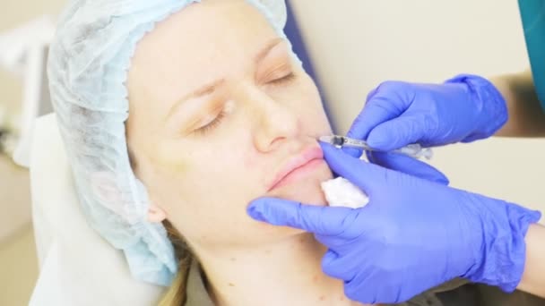 Лікар косметолог робить ін'єкції в обличчя пацієнта жінки. концепція краси та косметології. 4k. контурний пластик — стокове відео