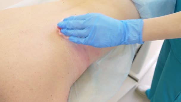 El médico el dermatólogo el cosmético introduce la lipolítica por medio de la jeringa en los pliegues grasos a la espalda de la mujer del paciente. 4k — Vídeo de stock