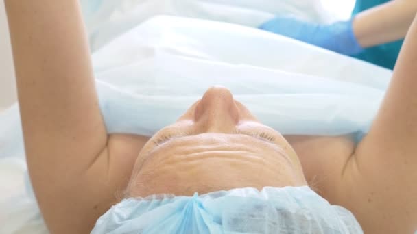 Ein Dermatologe-Kosmetologe Arzt spritzt Lipolit mit einer Spritze in die Fettfalten auf dem Bauch der Patientin. 4k. — Stockvideo