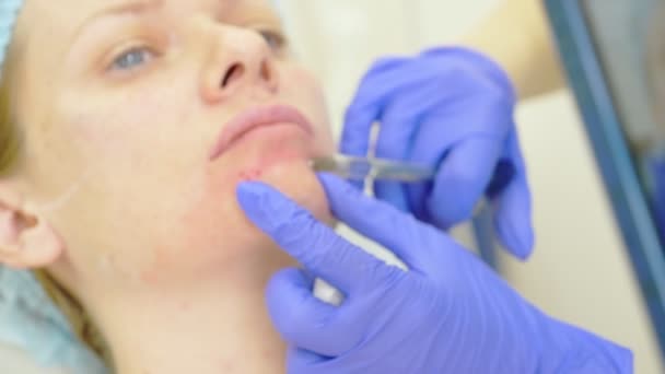 De arts schoonheidsspecialiste maakt injecties in het gezicht van de vrouwelijke patiënt. concept van schoonheid en cosmetologie. 4k. — Stockvideo