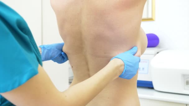 Gruba kobieta przygotowuje się do medycznej liposukcji. Lekarz rysuje znacznik, mark z tyłu. 4k — Wideo stockowe