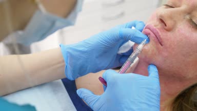Doktor-güzellik uzmanı hasta dudakları artırmak için enjeksiyonları yapar. Güzellik ve kozmetik kavramı. 4k.