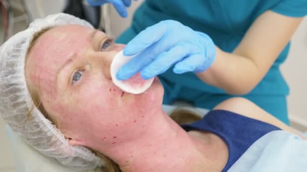 Dokter-ahli kosmetologi membuat suntikan untuk meningkatkan bibir pasien. konsep keindahan dan kosmologi. 4k . — Stok Video