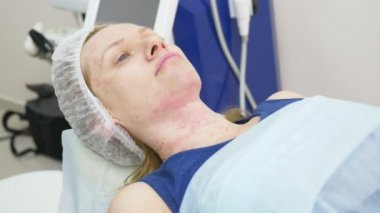 Doktor Şevval özçelik güzellik bayan hasta karşısında enjeksiyonları yapar. Güzellik ve kozmetik kavramı. 4k.