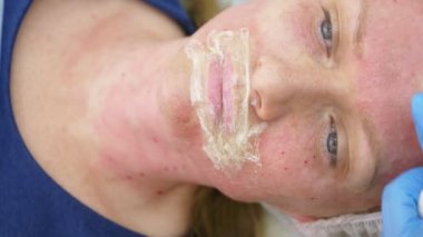 Doktor Şevval özçelik güzellik bayan hasta karşısında enjeksiyonları yapar. Güzellik ve kozmetik kavramı. 4k.