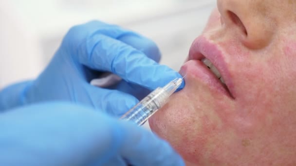 El médico-cosmetólogo realiza inyecciones para aumentar los labios del paciente. concepto de belleza y cosmetología. 4k . — Vídeos de Stock