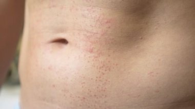 4k, bir adam çıplak bir gövde ile bir kırmızı döküntü karnına çizikler. Ağır çekim