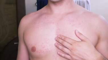 4k, bir adam çıplak bir gövde ile bir kırmızı döküntü karnına çizikler. Ağır çekim