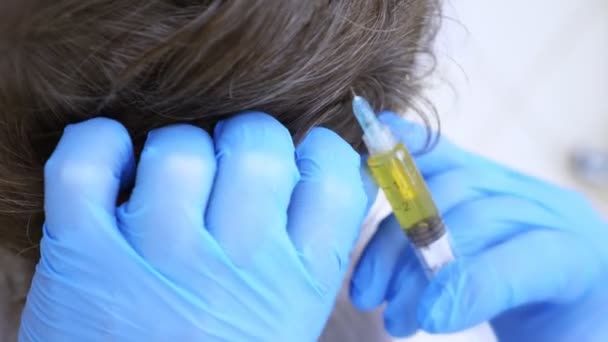 Förfarandet för kosmetologi och Centrifugera i plasmolifting är en arm som gör plasma injektioner i hårbotten av en man. 4k, slowmotion. plasmolifting i hårbotten — Stockvideo