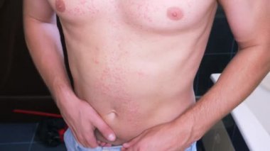 4k, bir adam çıplak bir gövde ile bir kırmızı döküntü karnına çizikler. Ağır çekim