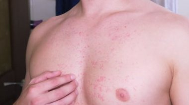 4k, bir adam çıplak bir gövde ile bir kırmızı döküntü karnına çizikler. Ağır çekim