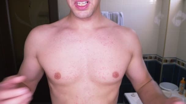 4 k、裸の胴体を持つ男は、彼の胃に赤い発疹を傷します。スローモーション — ストック動画