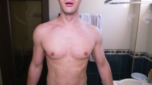 4k, en man med en naken torso repor ett rött utslag på magen. Slow motion — Stockvideo