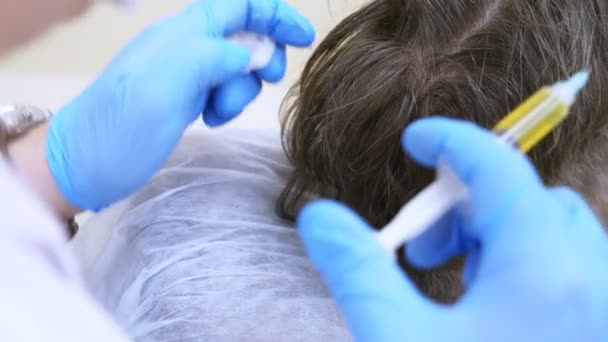 The procedure of cosmetology and centrifuge for plasmolifting is an arm that makes plasma injections into the scalp of a man. 4k, slow motion. plasmolifting of the scalp — Stock Video