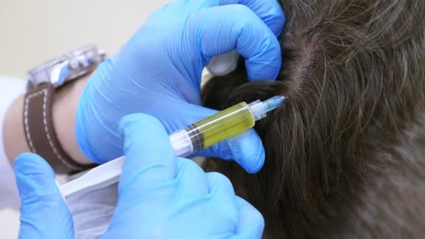 The procedure of cosmetology and centrifuge for plasmolifting is an arm that makes plasma injections into the scalp of a man. 4k, slow motion. plasmolifting of the scalp — Stock Video