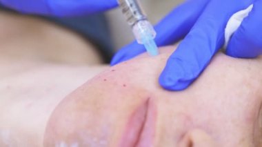 Doktor Şevval özçelik güzellik bayan hasta karşısında enjeksiyonları yapar. Güzellik ve kozmetik kavramı. 4k.