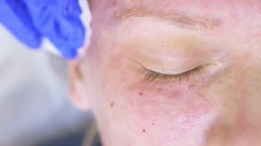 Doktor Şevval özçelik güzellik bayan hasta karşısında enjeksiyonları yapar. Güzellik ve kozmetik kavramı. 4k.