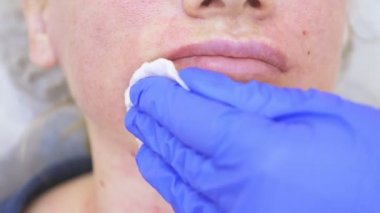 Doktor Şevval özçelik güzellik bayan hasta karşısında enjeksiyonları yapar. Güzellik ve kozmetik kavramı. 4k