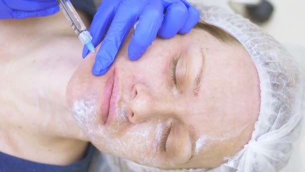 Лікар косметолог робить ін'єкції в обличчя пацієнта жінки. концепція краси та косметології. 4k . — стокове відео