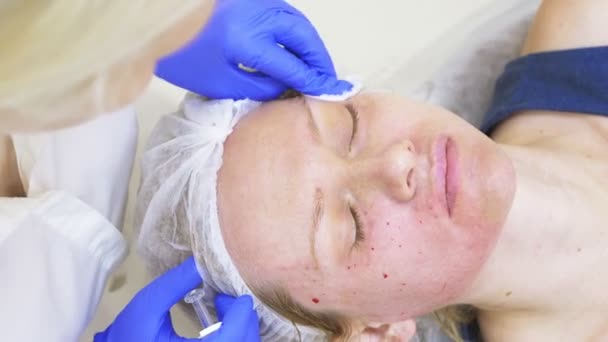 El médico esteticista hace inyecciones en la cara de la paciente femenina. concepto de belleza y cosmetología. 4k . — Vídeos de Stock