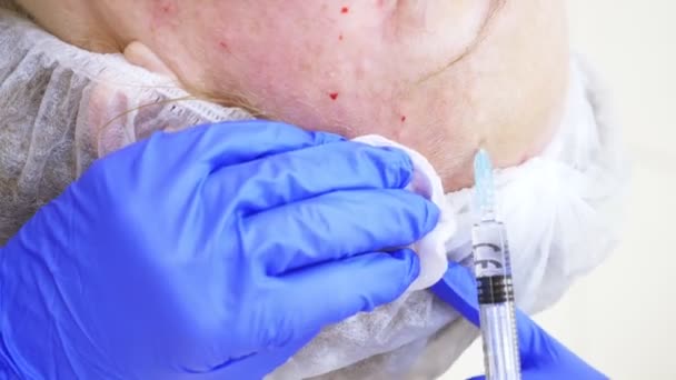 Le médecin esthéticienne fait des injections au visage de la patiente. concept de beauté et de cosmétologie. 4k . — Video