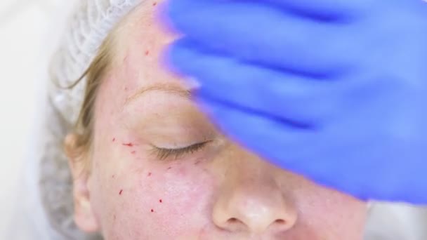 Läkare kosmetolog gör injektioner inför den kvinnliga tålmodig. begreppet skönhet och kosmetologi. 4k. — Stockvideo