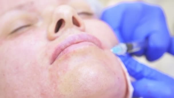 der Arzt Kosmetikerin macht Injektionen in das Gesicht der Patientin. Konzept der Schönheit und Kosmetologie. 4k.