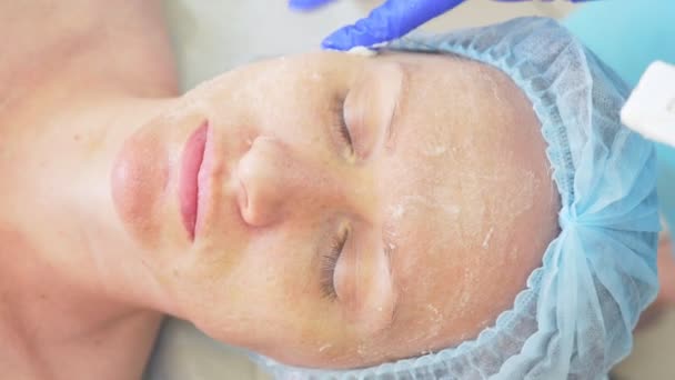 Close up van schoonheid procedure. Schoonheidsspecialiste schoonmaak gezichtsmasker. Peeling. Schoonheids- en huidverzorging. Slowmotion 4k — Stockvideo