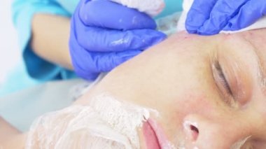 bir dermatolog doktor ofisinde yüz temizliği için yordam. 4 k, yakın çekim, ağır çekim. Aşılama için virüslü Püstüllü sivilce sıkma