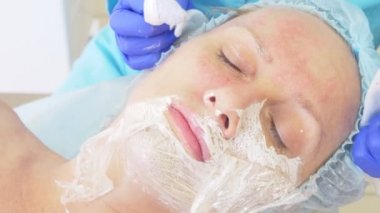 bir dermatolog doktor ofisinde yüz temizliği için yordam. 4 k, yakın çekim, ağır çekim. Aşılama için virüslü Püstüllü sivilce sıkma