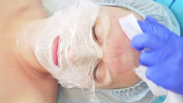 Procedimento para limpar o rosto no consultório médico de um dermatologista. 4K, close-up, câmara lenta. Espremendo a acne pustulosa infectada para inoculação — Vídeo de Stock