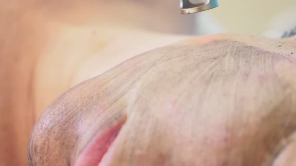 Koolstof gezichtsbehandeling. Laserpulsen reinigt de huid van het gezicht. Hardware cosmetologie behandeling. koolstof peeling. Close-up. Super Slow motion — Stockvideo