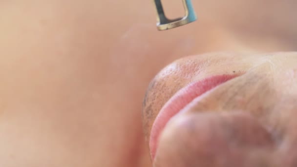 Koolstof Gezichtsbehandeling Laserpulsen Reinigt Huid Van Het Gezicht Hardware Cosmetologie — Stockvideo