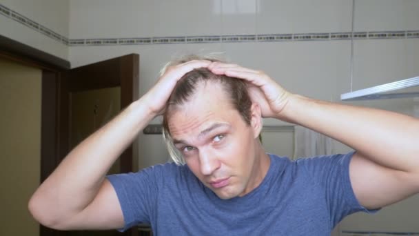 Young attractive man inspects a receding hairline in the bathroom. Baldness — Stock Video