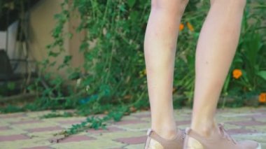 Sivrisinek ısırıkları bacak el ile cilt üzerinde yumuşak kaşıntılı kırmızı diken diken kaşı. 4 k, yakın çekim, ağır çekim çekim, steadicam