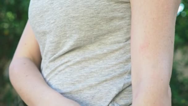 Rasca las protuberancias rojas suaves que pican en la piel debido a las picaduras de mosquitos en la mano. 4k, primer plano, disparo en cámara lenta, steadicam — Vídeos de Stock