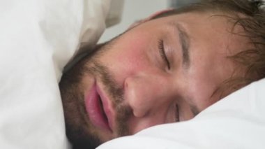 hasta genç adam ateşli bir battaniye ile örtülü yatakta uyuyor