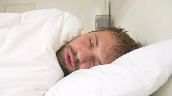 Chory młody człowiek z gorączką śpi w łóżku, objęte koc — Zdjęcie stockowe