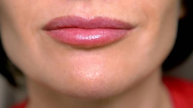 Süper yakın yukarı. Dudak parlaklık ile kadın dudaklar, gülümseme. mukoza dudaklarının dermatolojik hastalığı, Fordyce granül